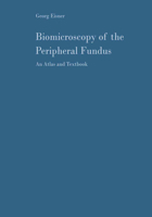 Biomicroscopy of the Peripheral Fundus: An Atlas and Textbook 3642858058 Book Cover
