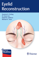 Eyelid Reconstruction 1626238235 Book Cover