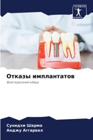 &#1054;&#1090;&#1082;&#1072;&#1079;&#1099; &#1080;&#1084;&#1087;&#1083;&#1072;&#1085;&#1090;&#1072;&#1090;&#1086;&#1074; 620526238X Book Cover