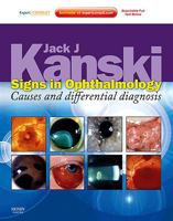 Signs in Ophthalmology: Causes and Differential Diagnosis [With Access Code] 0723435480 Book Cover