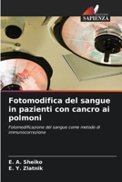 Fotomodifica del sangue in pazienti con cancro ai polmoni: Fotomodificazione del sangue come metodo di immunocorrezione (Italian Edition) 620348766X Book Cover