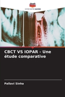 CBCT VS IOPAR - Une étude comparative (French Edition) 6207664264 Book Cover