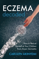 Eczema Decoded: How to Rescue Yourself or Your Children from Atopic Dermatitis 1999699637 Book Cover