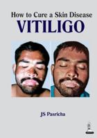 How to Cure a Skin Disease: Vitiligo 9351521192 Book Cover