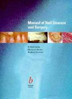 Diseases of the nails and their management 0632010584 Book Cover