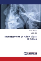 Management of Adult Class III Cases 3659397210 Book Cover