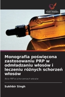 Monografia poswiecona zastosowaniu PRP w odmladzaniu wlosów i leczeniu róznych schorzen wlosów (Polish Edition) 6209923135 Book Cover