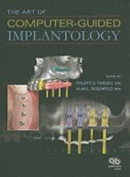Art of Computer-Guided Implantology 0867154772 Book Cover