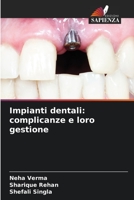 Impianti dentali: complicanze e loro gestione 6205760274 Book Cover