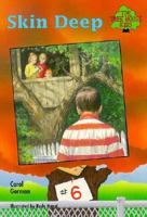 Skin Deep (The Tree House Kids Series, #6) 0570047471 Book Cover