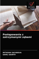 Postępowanie z zatrzymanymi zębami 620360335X Book Cover