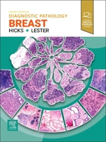 Diagnostic Pathology: Breast 0443286817 Book Cover
