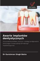 Awarie implantów dentystycznych 6202366664 Book Cover