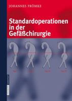 Standardoperationen in Der Gefasschirurgie 3798514607 Book Cover
