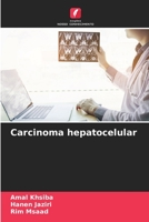 Carcinoma hepatocelular (Portuguese Edition) B0CKRD6LXX Book Cover