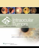 Intraocular Tumors: An Atlas and Text 0781775809 Book Cover