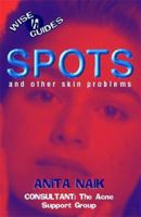 Spots (Wise Guides) 034075737X Book Cover