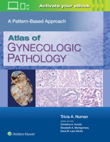 Atlas of Gynecologic Pathology: A Pattern Based Approach 1975124766 Book Cover
