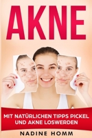 Akne: Mit natürlichen Tipps Pickel und Akne loswerden 1720224366 Book Cover