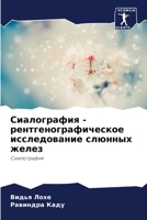 Сиалография - рентгеногр 6207261593 Book Cover