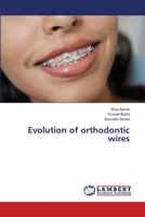 Evolution of orthodontic wires 6139581982 Book Cover