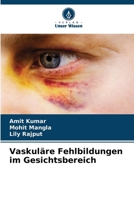 Vaskuläre Fehlbildungen im Gesichtsbereich 6207434501 Book Cover