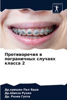 Противоречия в пограничных случаях класса 2 620367933X Book Cover