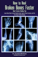 How to Heal Broken Bones Faster. Bone Fracture Healing Tips: Learn About Bone Fracture Healing Foods, Types of Bone Fractures, and the Five Stages of Bone Healing 1646350162 Book Cover