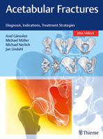 Acetabular Fractures : Diagnosis, Indications, Treatment Strategies 313241560X Book Cover