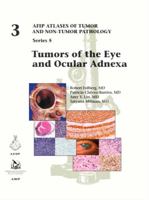 Tumors of the Eye and Ocular Adnexa 193347792X Book Cover