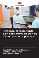 Présence concomitante d'un carcinome du sein et d'une cataracte précoce (French Edition) 6208015251 Book Cover