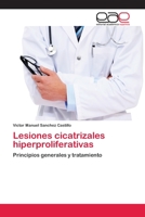 Lesiones Cicatrizales Hiperproliferativas 3659086940 Book Cover