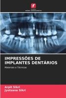 IMPRESSÕES DE IMPLANTES DENTÁRIOS: Materiais e Técnicas 6205387018 Book Cover