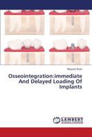 Osseointegration:immediate And Delayed Loading Of Implants 3659391093 Book Cover