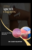 LIVING ABOVE CELLULITIS: HOW CAN YOU TREAT CELLULITIS B0CH2P1J93 Book Cover