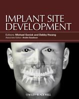 Implant Site Development 0813825121 Book Cover