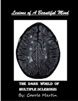 Lesions of A Beautiful Mind: The Dark World of Multiple Sclerosis B08BWGWGHD Book Cover