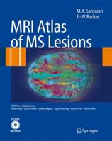 MRI Atlas of Lesions in Multiple Sclerosis 3642447813 Book Cover