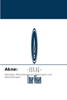 Akne:: Ätiologie, Pathophysiologie, Typologien und Behandlungen 6203482498 Book Cover