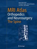 MRI Atlas: Orthopedics and NeurosurgeryThe Spine 3540335331 Book Cover