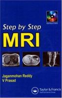 Step by Step MRI 184184537X Book Cover