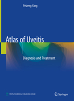 Atlas of Uveitis: Diagnosis and Treatment 9811537259 Book Cover