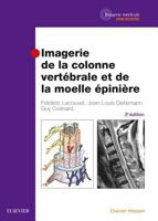 Imagerie de La Colonne Vertebrale Et de La Moelle Epiniere 2294747232 Book Cover