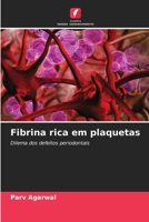 Fibrina rica em plaquetas: Dilema dos defeitos periodontais 620608101X Book Cover