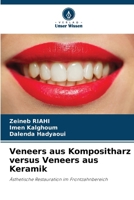 Veneers aus Kompositharz versus Veneers aus Keramik (German Edition) 6208587905 Book Cover