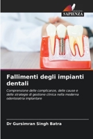 Fallimenti degli impianti dentali (Italian Edition) 6202366656 Book Cover