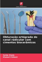 Obturação ortógrada do canal radicular com cimentos biocerâmicos (Portuguese Edition) 6630182391 Book Cover