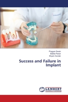 Success and Failure in Implant 6205502410 Book Cover