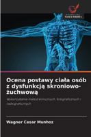 Ocena postawy ciala osób z dysfunkcja skroniowo-zuchwowa: Wykorzystanie metod klinicznych, fotograficznych i radiograficznych (Polish Edition) 6203915092 Book Cover