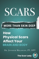 Scars: More Than Skin Deep: How Physical Scars Affect Your Body and Brain null Book Cover